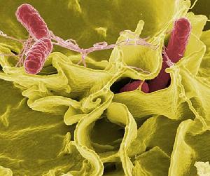 沙門氏菌（紅色部分）入侵人類細胞培基的色彩增強掃描電子顯微圖像強