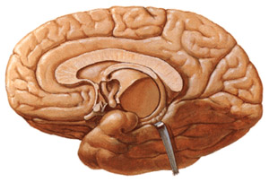 遺傳性凝血因子ⅩⅢ缺乏