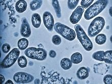 沙門菌食物中毒 沙門菌食物中毒