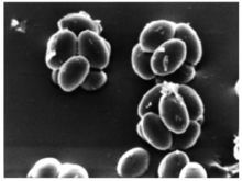 微生物超高壓處理前