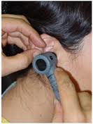 耳鏡檢查法