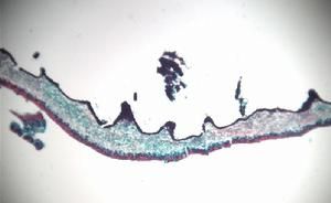 異層地衣 異層地衣