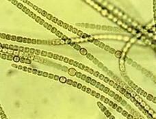 湖沼圓篩藻 湖沼圓篩藻