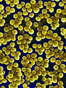 耐甲氧西林金黃色葡萄球菌
