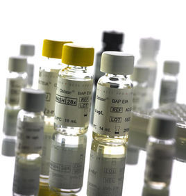 骨鹼性磷酸酶 骨鹼性磷酸酶