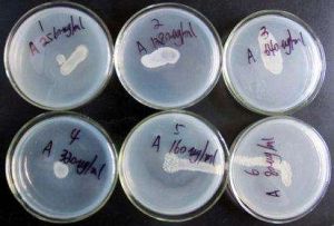 單向瓊脂擴散試驗 單向瓊脂擴散試驗