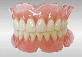 全口假牙 全口假牙