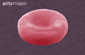 遺傳性橢圓形紅細胞增多症
