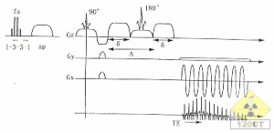 無症狀性腦梗死