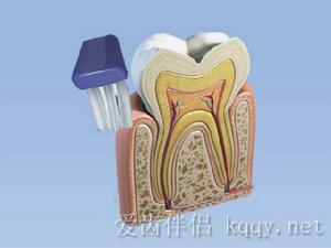 旋轉式刷牙法 旋轉式刷牙法