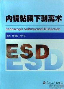 內鏡黏膜下剝離術 內鏡黏膜下剝離術