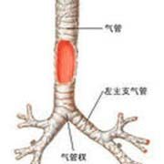 喘息性支氣管炎