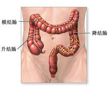 結腸癌圖