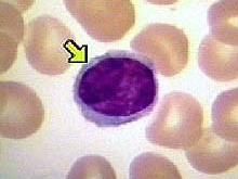 淋巴細胞計數 淋巴細胞計數