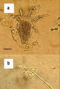 間型肋壺菌 間型肋壺菌