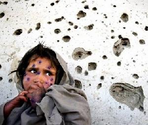 利什曼病 利什曼病