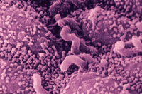 碳14尿素呼氣試驗