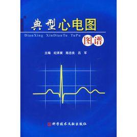 典型心電圖圖譜 典型心電圖圖譜