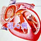 老年猝死型冠心病