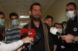 土耳其面部移植者尤格爾&middot;阿卡