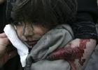 一名在以軍空襲中受傷的巴勒斯坦兒童正在等待治療