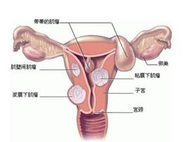 子宮[產生月經和孕育胎兒的器官]