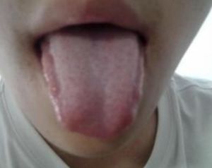 口乾舌燥 口乾舌燥