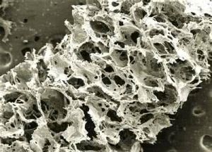 海綿狀組織 海綿狀組織