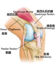 股四頭肌肌腱斷裂