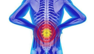 腰間盤突出 腰間盤突出