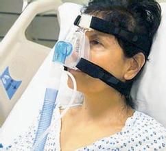 無創通氣 無創通氣