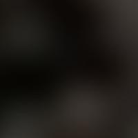 IC 1214 RASS 彩色圖