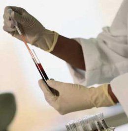 免疫耐受 免疫耐受