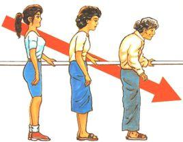 世界骨質疏鬆日 世界骨質疏鬆日