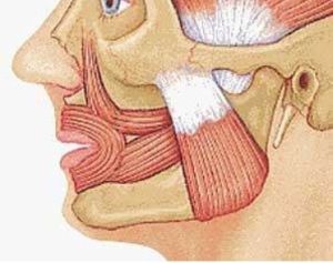 咬肌肥大 咬肌肥大