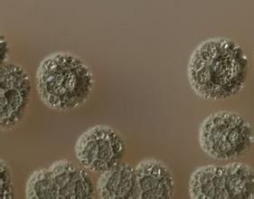 和田山鏈黴菌 和田山鏈黴菌