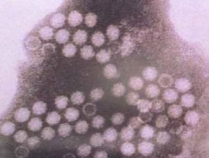 細小病毒 細小病毒