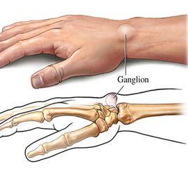 車軸關節 車軸關節