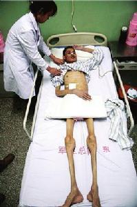 靜脈營養 靜脈營養