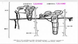 滲透性利尿 滲透性利尿