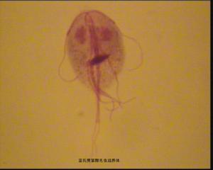 藍氏賈第鞭毛蟲