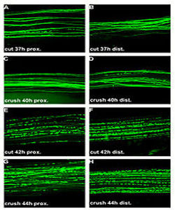 瓦勒變性 瓦勒變性
