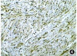 波形蛋白 波形蛋白