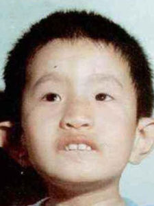 18三體綜合徵 18三體綜合徵