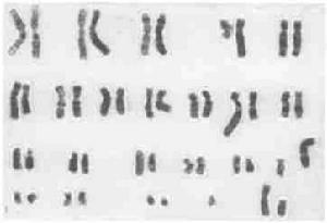 （圖）染色體檢查