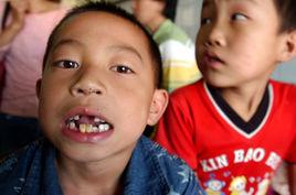 郴州血鉛中毒事件 郴州血鉛中毒事件