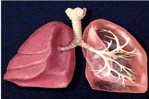 外源性過敏性肺泡炎