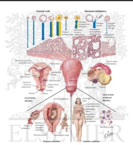 功能性子宮出血
