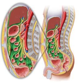 腹膜內位器官 腹膜內位器官