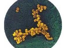 金黃色葡萄球菌肺炎